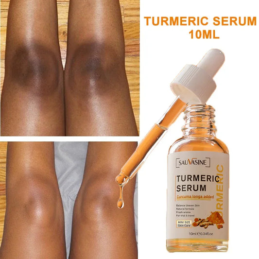 10 ml Turmeric Serum for Lightning of Dark Spots Removal of Dark Pigmentation for Face and Body